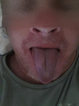 MMS 87065